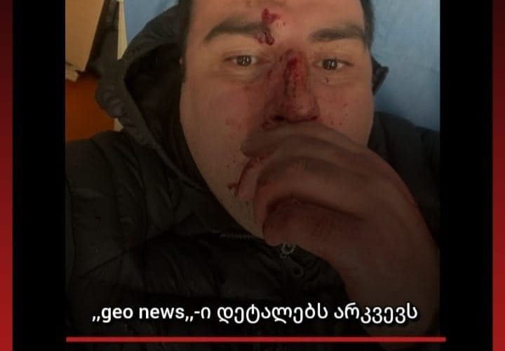 ცოტა ხნის წინ თავდასხმა მოხდა მსახიობ ბესო ზანგურზე
