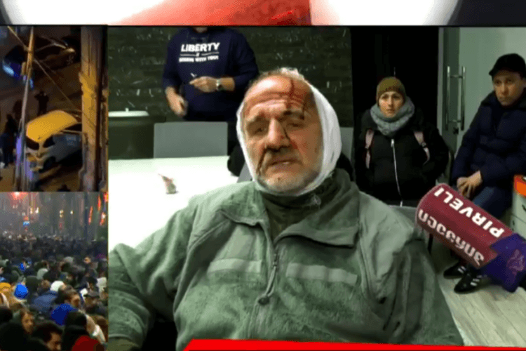 „კოალიცია ცვლილებისთვის“ წევრ კობა ხაბაზს თავს დაესხნენ