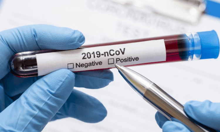 საქართველოში კოვიდსტატისტიკა თვეში ერთხელ განახლდება