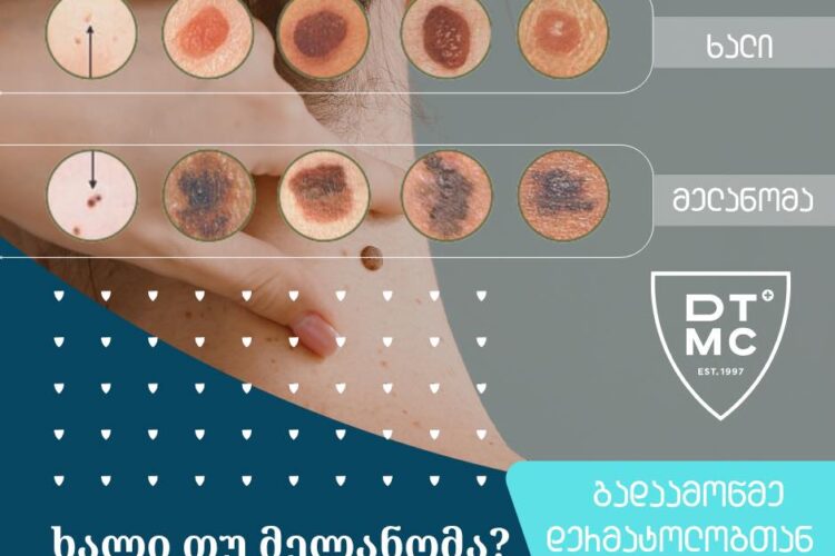 დავით ტატიშვილის სამედიცინო ცენტრი – ჯანმრთელობა იწყება დაკვირვებით !